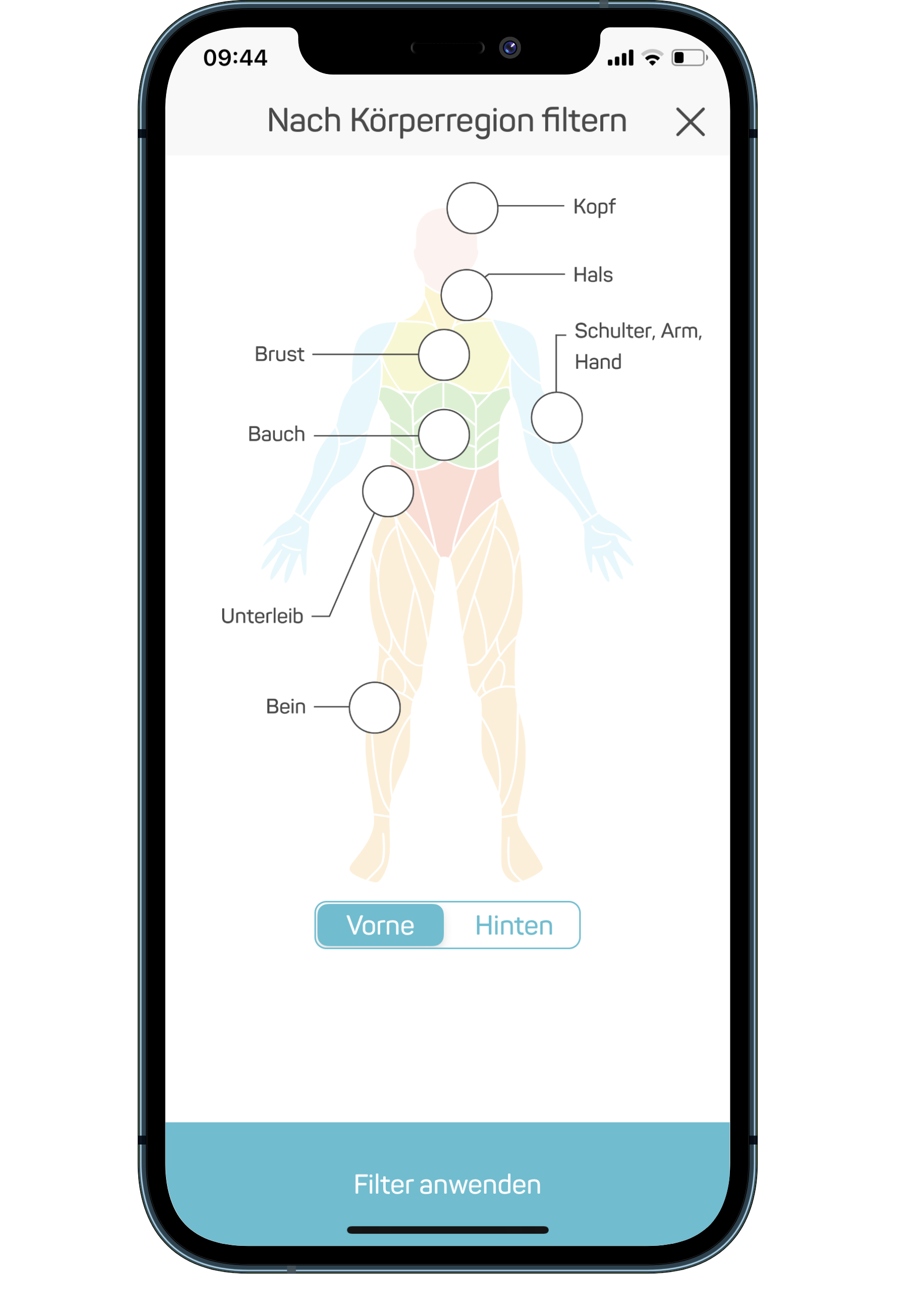 Vivellio body-region filter